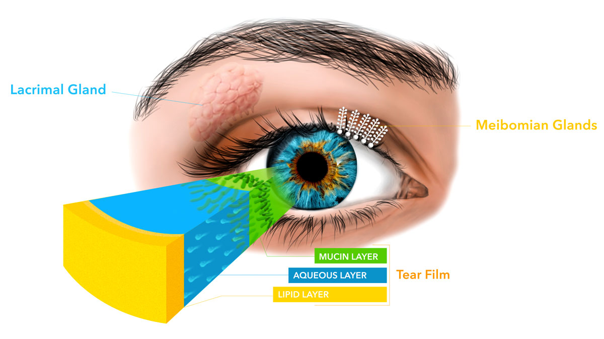 Illustration showing the lacrimal gland, meibomian glands and the layers of the tear film